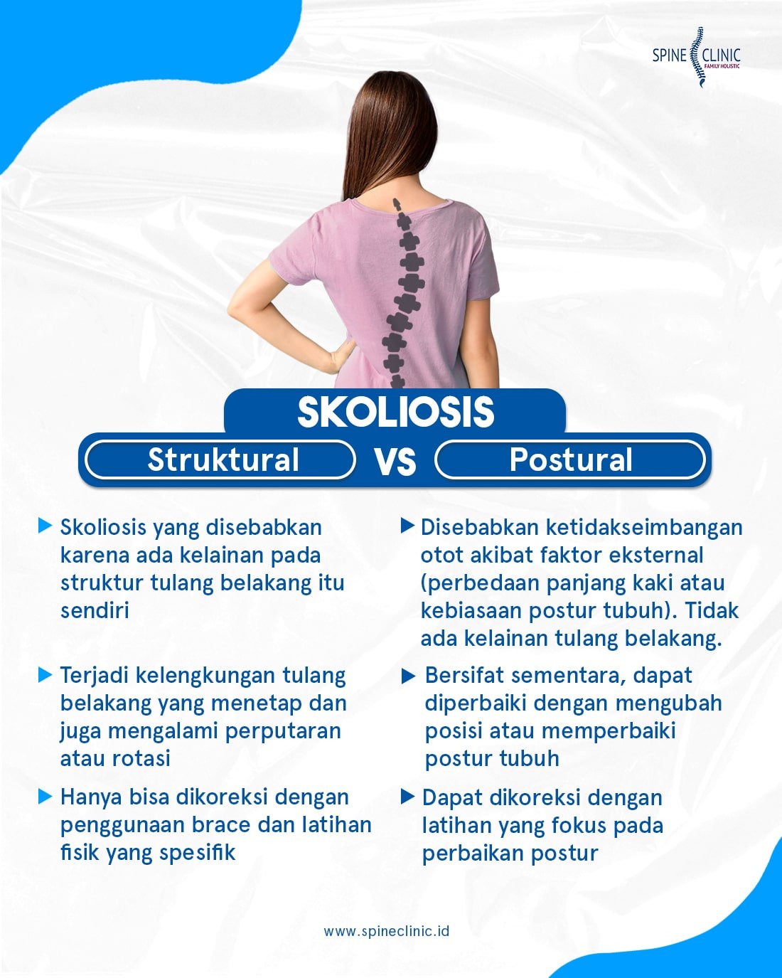 jenis skoliosis
